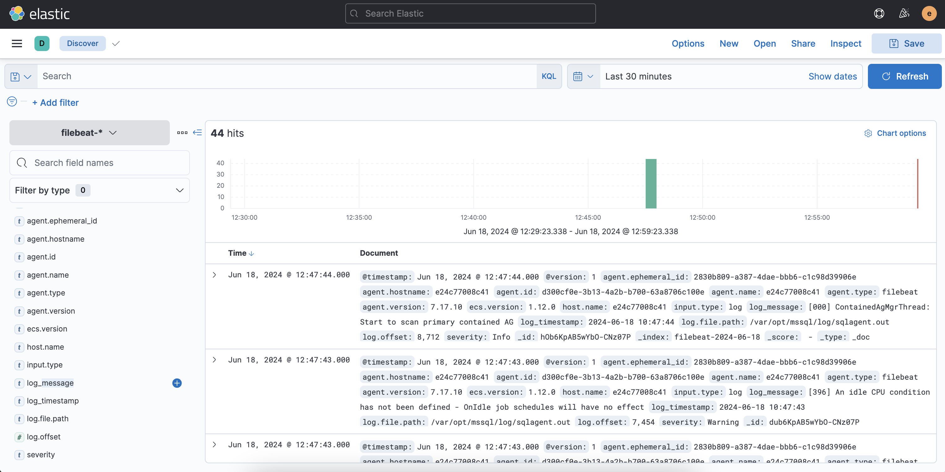 Kibana